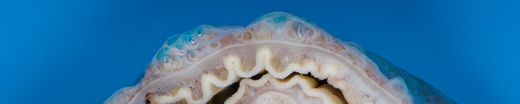 Pneumatosis cystoides intestinalis